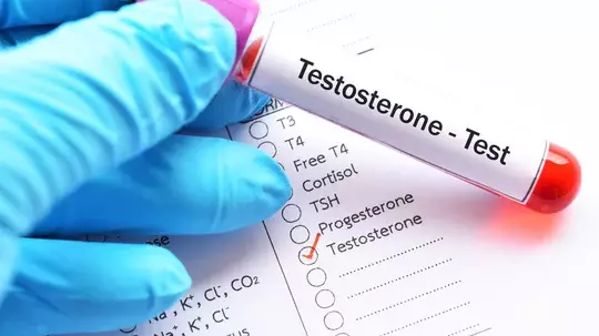 Testosterone Test Dr Julia Ward